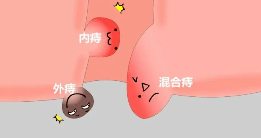 ̯@ʲô@ôʹ(dng)Ѫ˨
